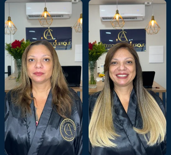 Loiro e Megahair
